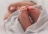 Doctors, very uncommon, United States , twins three days, Gabriella (Gabby) Grace