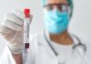 California declares an emergency situation due to an outbreak of monkeypox