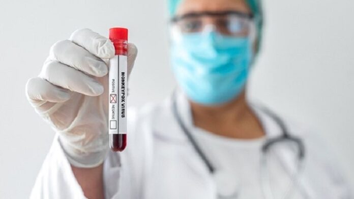 California declares an emergency situation due to an outbreak of monkeypox California declares an emergency situation due to an outbreak of monkeypox